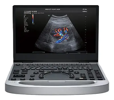 mindray MU7