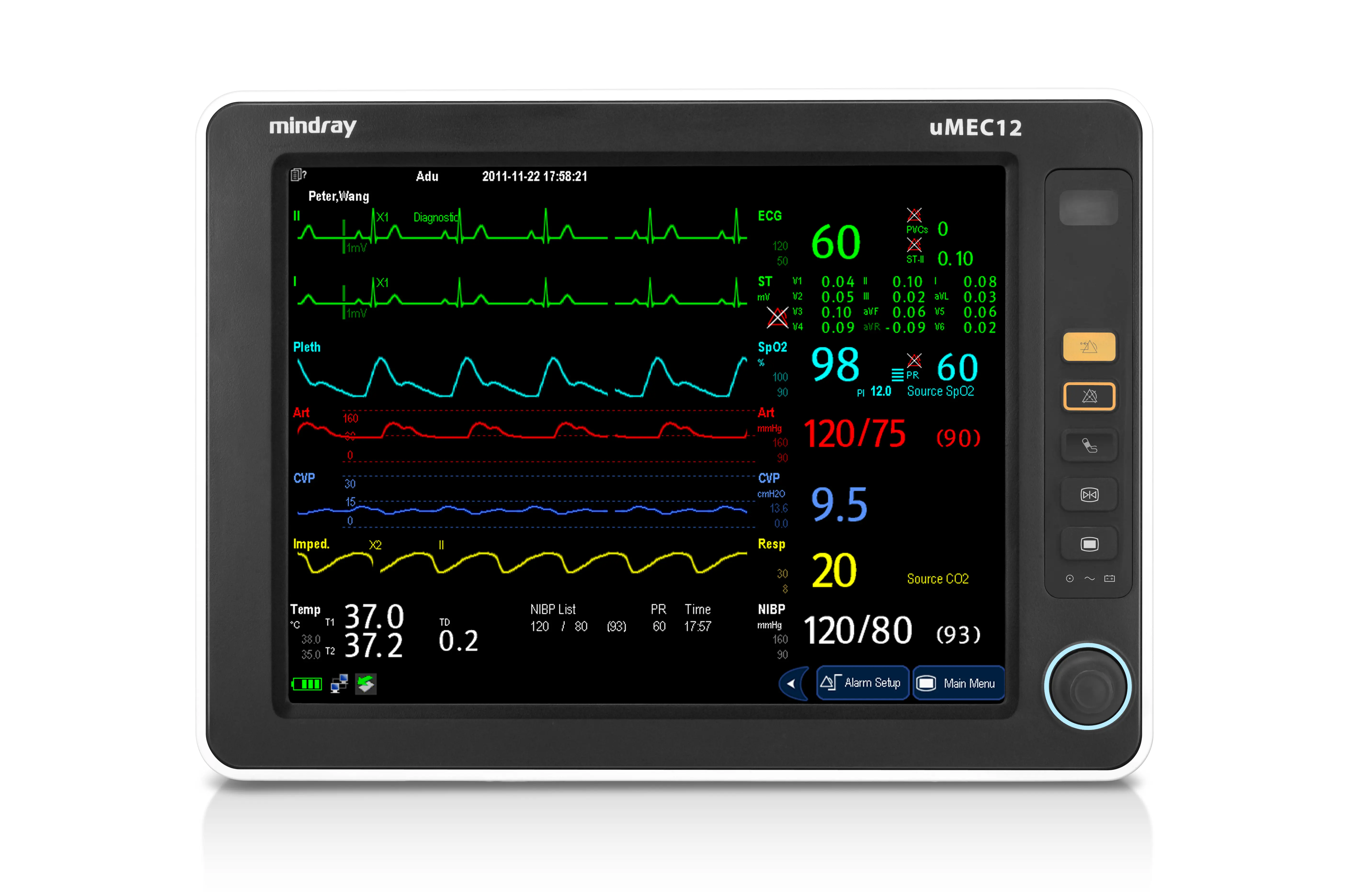Mindray uMEC Patientenmonitor Mindray uMEC-Serie